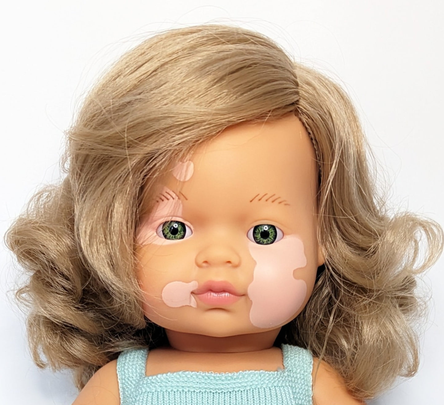 Close up image of Baby Doll Caucasian Dirty Blonde Girl with Vitiligo face