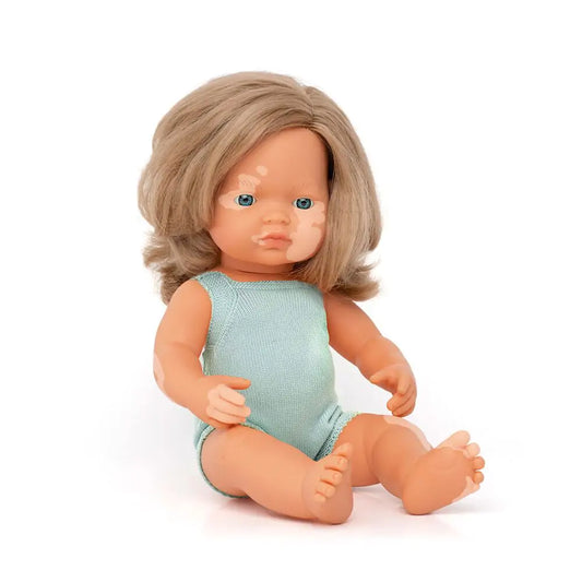 Baby Doll Caucasian Dirty Blonde Girl with Vitiligo 15" Colorful Edition