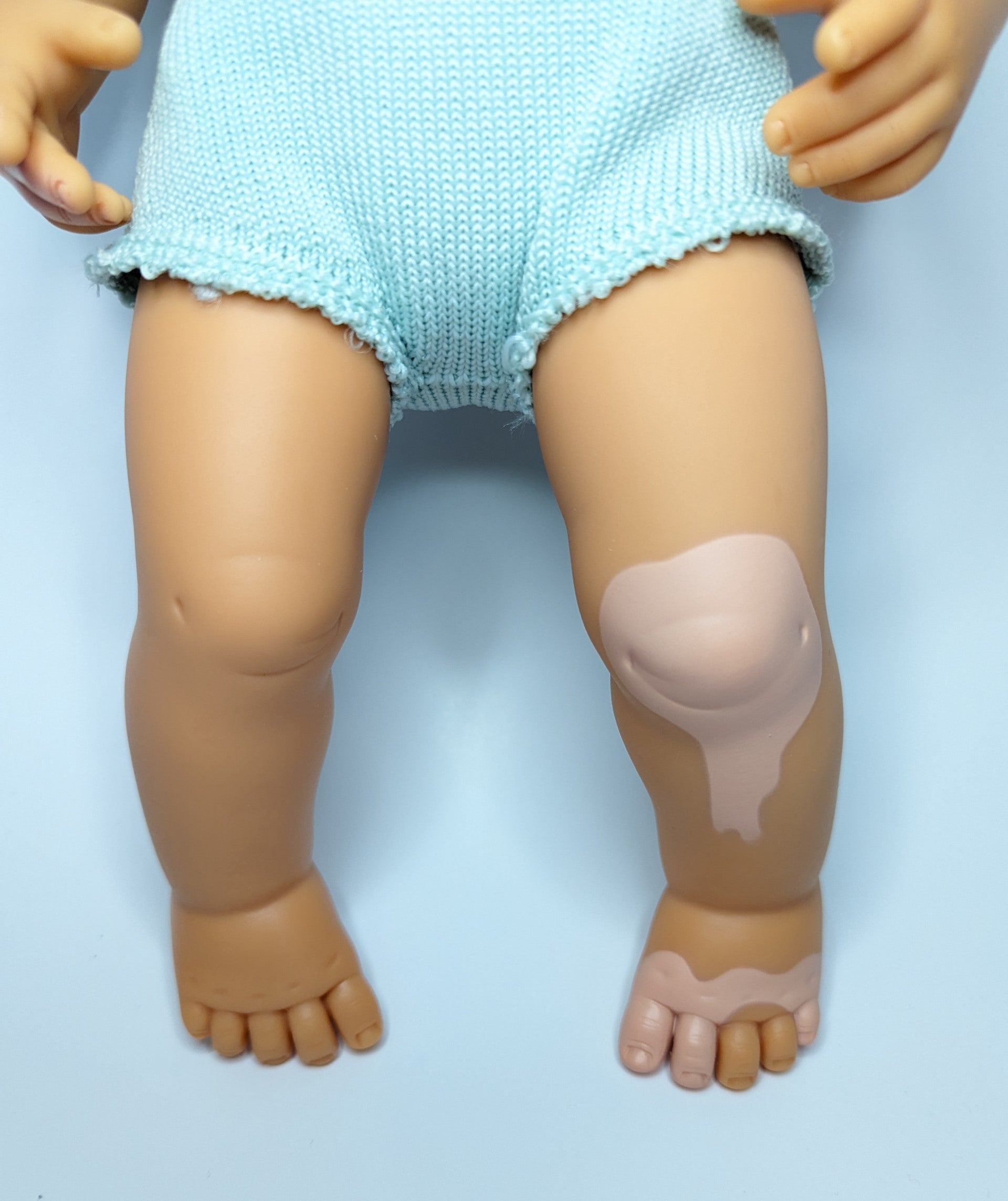 Close up image of Baby Doll Caucasian Dirty Blonde Girl with Vitiligo legs